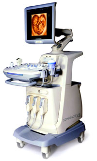 Доплерография при беременности